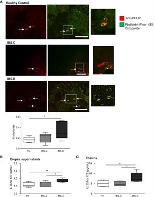 Mucosal Tuft Cell Density Is Increased in Diarrhea-Predominant Irritable Bowel Syndrome Colonic Biopsies